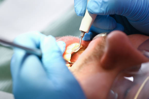 Best Emergency Treatment for Toothache in Surf City, NJ